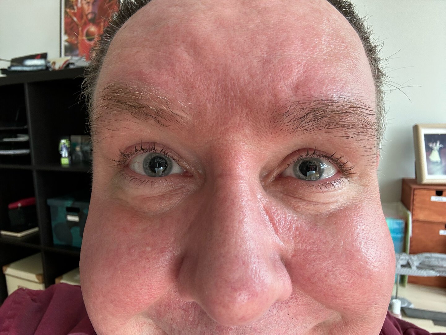 Closeup of my face showing dilated eyes, having just come from an eye exam. Shame on you for considering the other options.