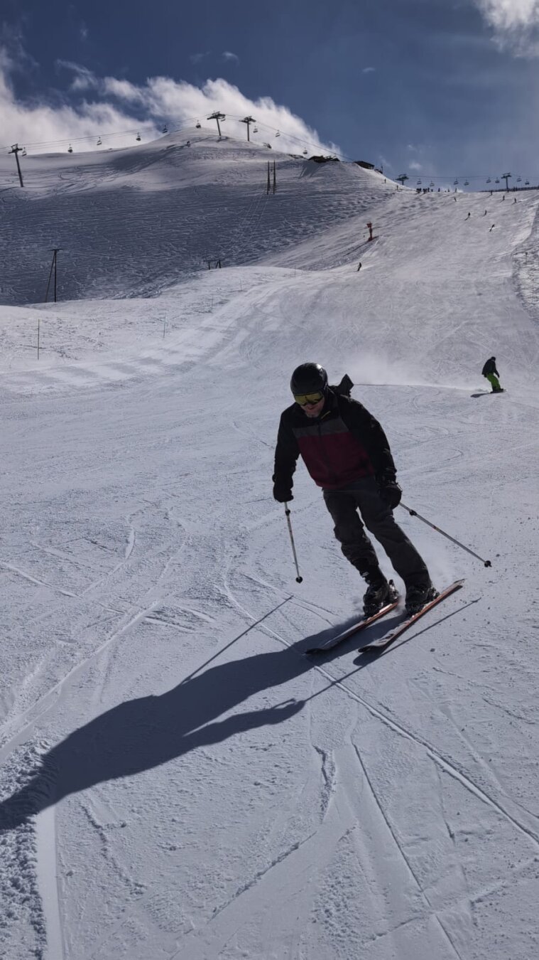 Me skiing like an idiot on a sunny ski slope